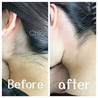 川越ローマピンク 光脱毛＆ワックス脱毛のエステ・リラクイメージ