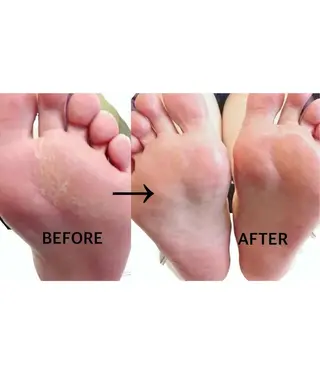 ネイル ______ TKM  NAILのネイルデザイン