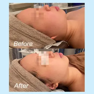 Remina clinical salon所属・ハイフ美肌専門 Remina.c.sのエステ・リラクイメージ