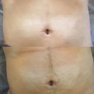 YES脱毛サロン　大阪京橋店所属・メンズ脱毛サロン YESのエステ・リラクイメージ