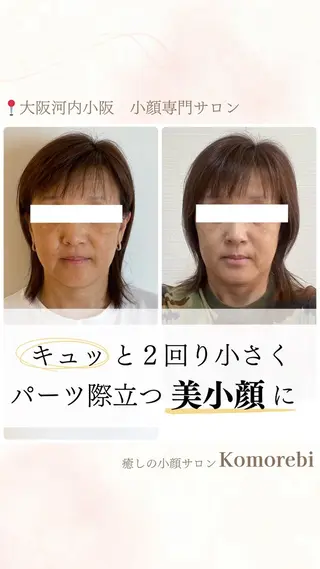 営業電話❌小顔サロン Komorebiのエステ・リラクイメージ