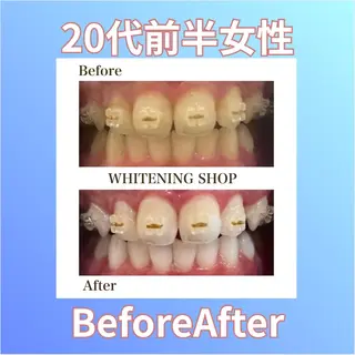 ホワイトニングショップ西原所属・下川 藍子のその他イメージ