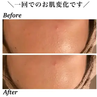 Bellesthe （ベルエステ）のエステ・リラクイメージ