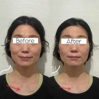 Private salon La.所属・Stellum 小顔矯正&ヘッドスパのエステ・リラクイメージ