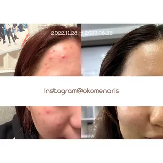 杉浦里沙⌇ 居心地いいエステのエステ・リラクイメージ