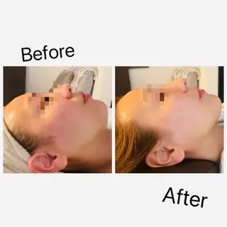 LEMONADE レモネードのエステ・リラクイメージ