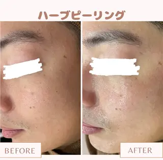 メンズ キッズ Amaryllis 💜河田のエステ・リラクイメージ