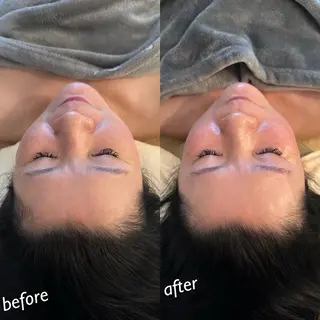 うなじ脱毛/美肌脱毛 LABELのエステ・リラクイメージ