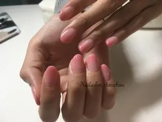 ネイル Nailsalon chouchouette所属・爪のお悩みサロン シュシュエットのネイルデザイン