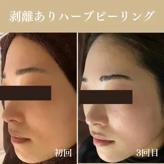 Oncebell. Bodymake&beautysalon所属・Oncebell. ワンベルのエステ・リラクイメージ