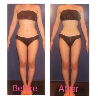 全身痩身✨ キレイサローネ表参道のエステ・リラクイメージ