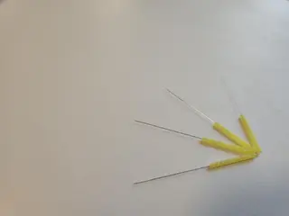 即効⚡小顔美容鍼🪡 むくみたるみ脂肪解消のエステ・リラクイメージ