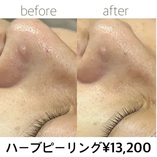 田辺🌿毛穴ケア サロンリテルナのエステ・リラクイメージ