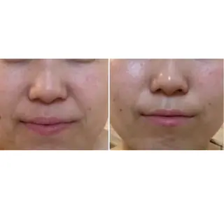 メナードフェイシャルサロン道央所属・yukari mamaのエステ・リラクイメージ