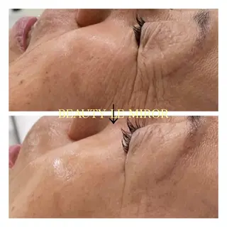 ビューティー ミロワールのエステ・リラクイメージ