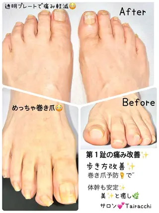 ネイル Tairacchi ﾀｲﾗｯﾁのエステ・リラクイメージ