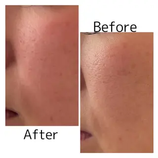 【敏感肌管理×小顔サロン】Belle orchid所属・敏感肌×小顔サロン 玲央奈のエステ・リラクイメージ