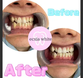 エクシアホワイト長野店所属・セルフホワイトニング エクシア長野店のその他イメージ