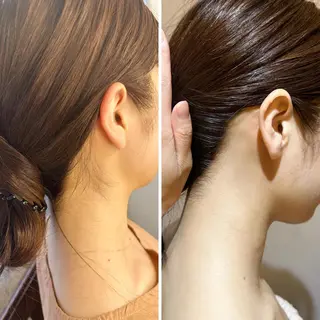 うなじ脱毛/美肌脱毛 LABELのエステ・リラクイメージ