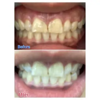 M渋谷店所属・Ｍ渋谷 ホワイトニングのその他イメージ