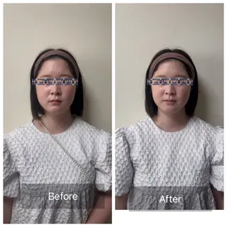 Ocouture所属・Ocouture ホワイトニング、小顔のその他イメージ