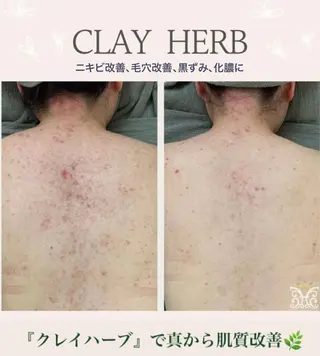 美肌&アロマ🌸 nana 中目黒のエステ・リラクイメージ