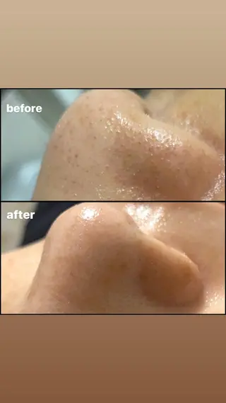 Y NAIL —BEAUTY SALON—所属・Y NAILのエステ・リラクイメージ