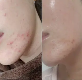 foi所属・【foi】 natsumi🌼のその他イメージ