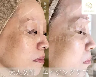 ハーブピーリング・毛穴ケア専門サロンSalon de LENA 栄店所属・ハーブピーリング専門 サロンドレナ　白藤のエステ・リラクイメージ