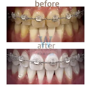 ホワイトニング ショップ本八幡店のエステ・リラクイメージ