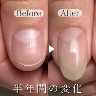 ネイル 深爪専門店 サロンリリーのネイルデザイン