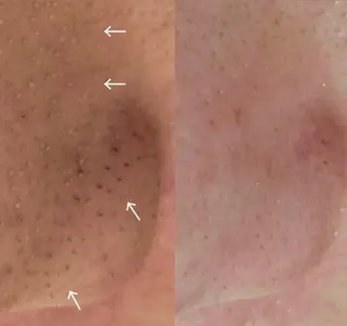 お肌のかかりつけサロンP.A.L.M.所属・【P.A.L.M.】 むき卵×毛穴レス肌のエステ・リラクイメージ