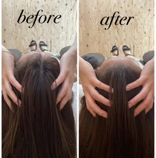 ate'所属・個室ドライヘッドスパ 🍃moriのエステ・リラクイメージ