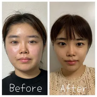 医療提携Ruby池袋店所属・医療提携Ruby小顔 ハーブピーリング加藤のエステ・リラクイメージ