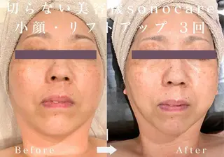 美肌脱毛＆小顔・フェ イシャル【SONA】のエステ・リラクイメージ