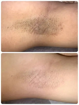 Laule'a ラウレアのエステ・リラクイメージ