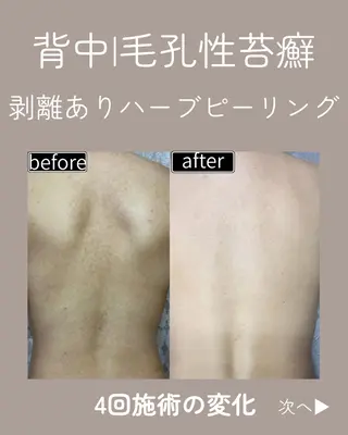 eto.所属・肌質改善サロンeto ニキビ・ニキビ跡のエステ・リラクイメージ