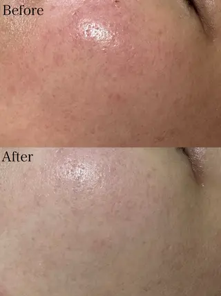 beautysalon LIMOA所属・松本 愛絵理のエステ・リラクイメージ