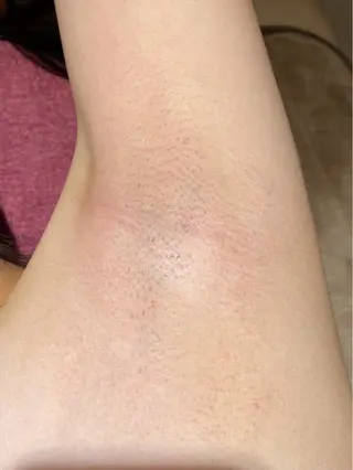 下赤塚 ベルミーランドのエステ・リラクイメージ