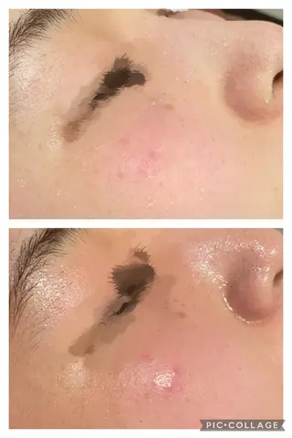 ロング カラー パーマ ヘアアレンジ メンズ キッズ ネイル マツエク・マツパ アイブロウ ニキビ特化型エステ 🍓最短で肌質改善のエステ・リラクイメージ