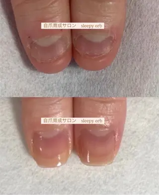 スリーピーオーブ所属・自爪育成眠れるサロン スリーピーオーブしずのネイルデザイン