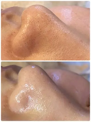 脱毛・エステサロン LuLuNのエステ・リラクイメージ