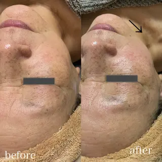 岸和田／久米田 MooMooのエステ・リラクイメージ