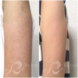 ank所属・ank アンクのマツエク・マツパデザイン