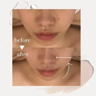 【vidyto】ヴィディトゥ所属・肌管理サロン vidyto　MOEのエステ・リラクイメージ