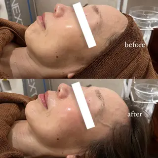 NOEL所属・フェイシャルエステ Utaiのエステ・リラクイメージ