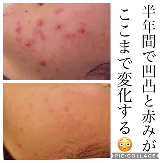 ミディアム カラー パーマ ヘアアレンジ キッズ ネイル マツエク・マツパ ニキビ・肌質改善専門 ♡人生が変わるサロンのエステ・リラクイメージ