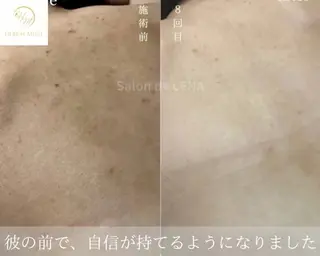 Grandir所属・ハーブピーリング専門 グランディール　武内のエステ・リラクイメージ