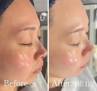 アンド ミルルのエステ・リラクイメージ