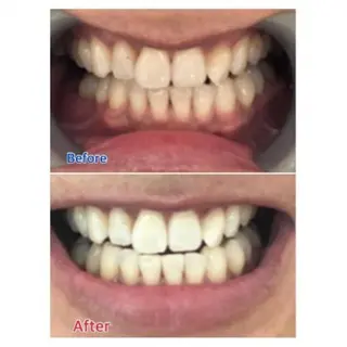 M渋谷店所属・Ｍ渋谷 ホワイトニングのエステ・リラクイメージ